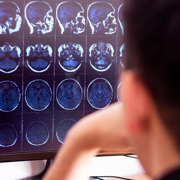 MAPS - A person is looking at brain scans on a screen, possibly related to a study or analysis related to Navy SEAL PTSD Study.